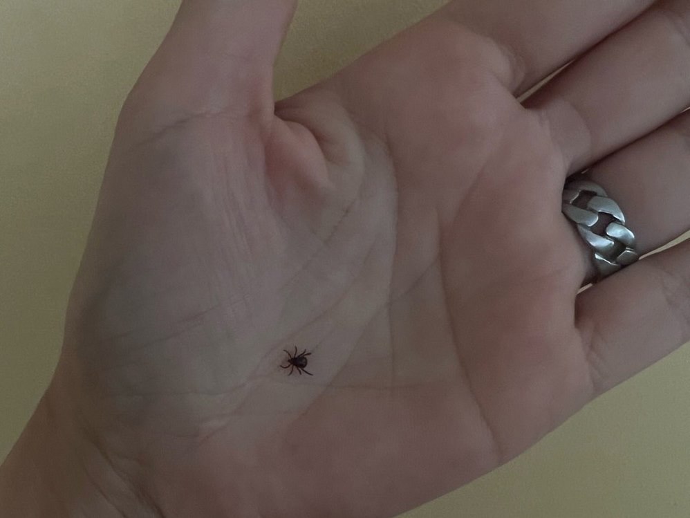 клещевой боррелиоз