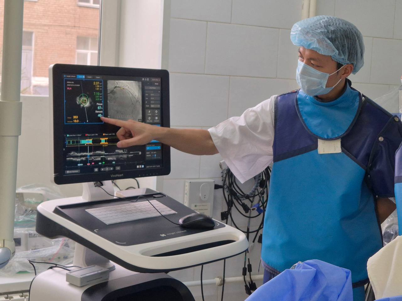 внутрисосудистый ультразвук