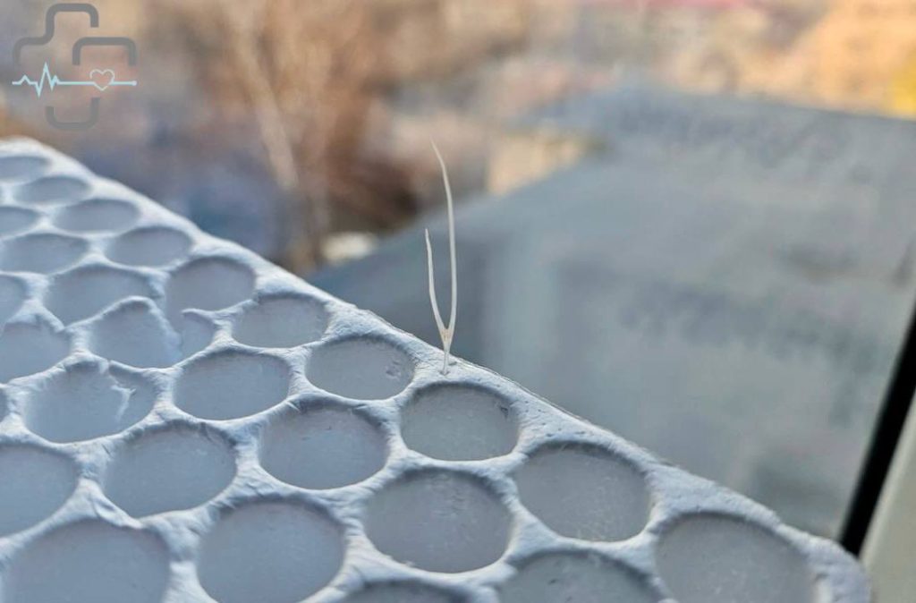 рыбья кость