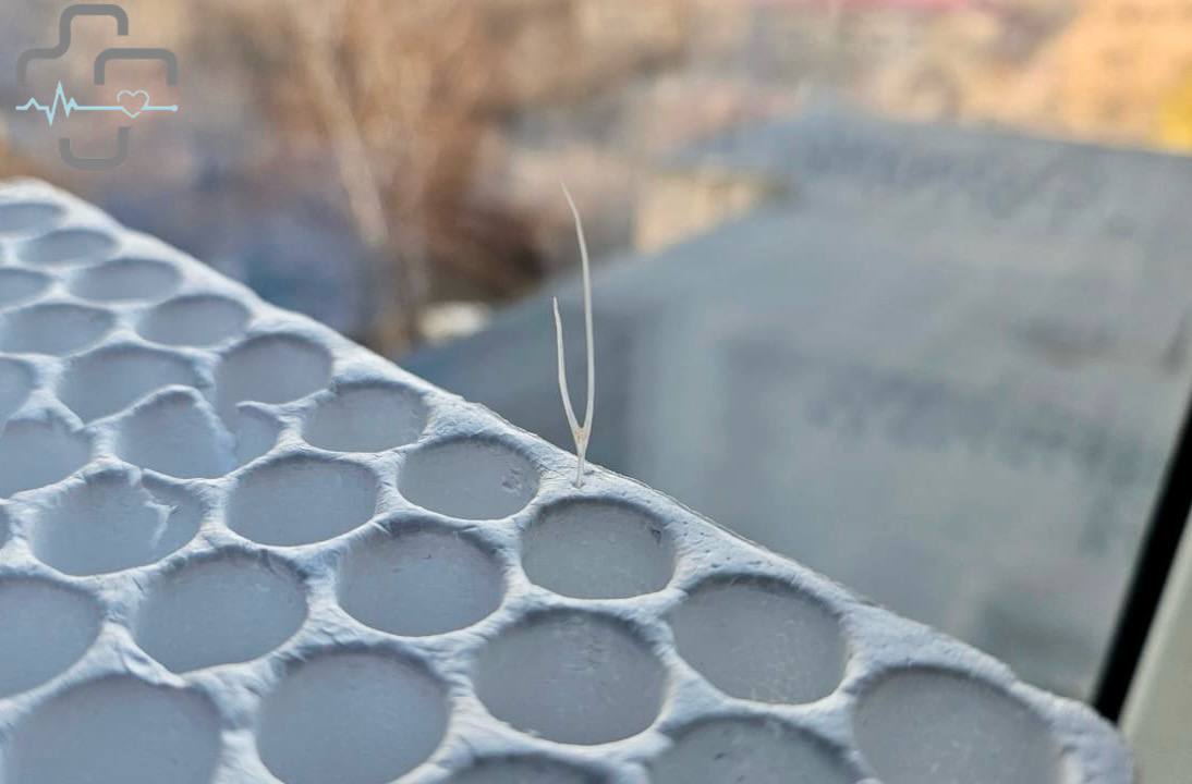 рыбья кость